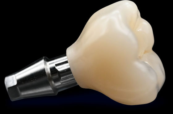 Αγορά CAD / CAM Implant Crown Bridge Υψηλή αισθητική Κρόνος Ζιρκόνια online manufacture