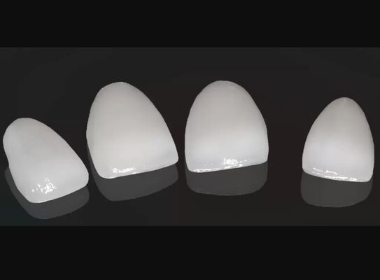 Αγορά Υψηλή αισθητική σύνθετο στέμμα Onlay Veneer Προσαρμόσιμο μέγεθος online manufacture