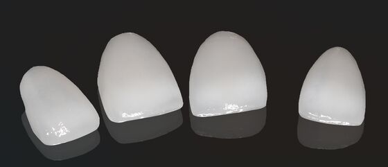 Υψηλή αισθητική σύνθετο στέμμα Onlay Veneer Προσαρμόσιμο μέγεθος