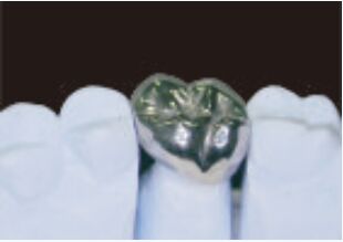 Πλήρης μεταλλικός στέμμα και γέφυρα υψηλής ακρίβειας Ασημένιο προσωρινό στέμμα